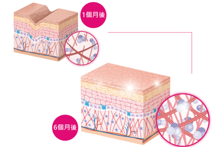SKINLayer_工作區域 1_工作區域 1